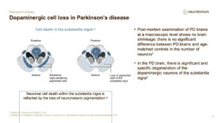 Parkinsons Disease – Neurobiology and Aetiology – slide 11